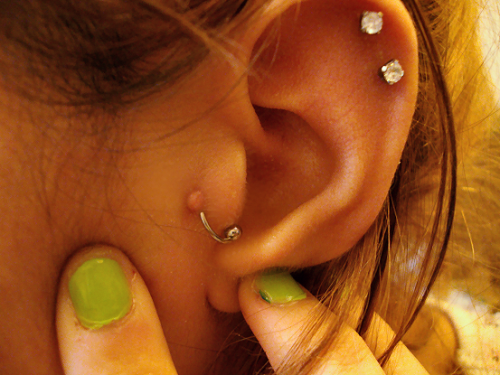 How-to-Heal-Piercing-Bumps